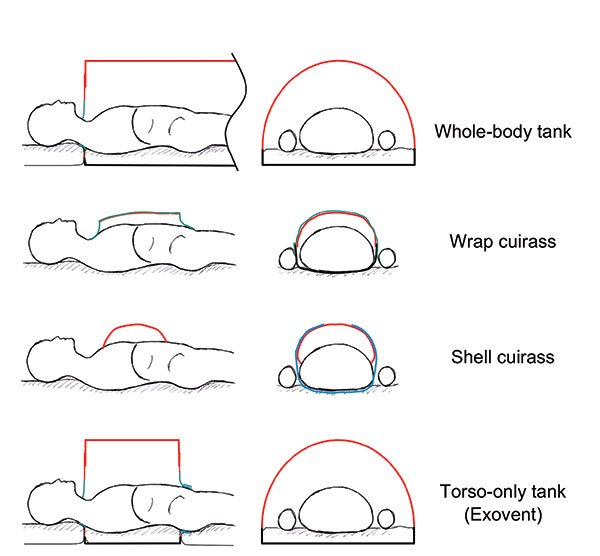 Types of negative pressure ventilator chambers